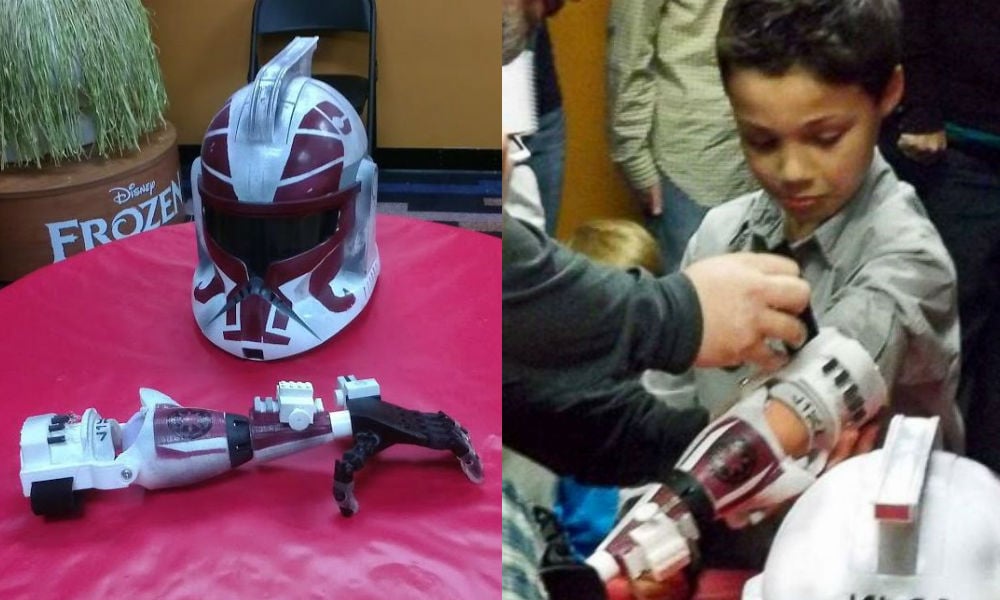 clone trooper prosthetic arm